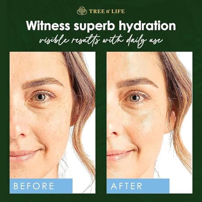 TREE OF LIFE BEAUTY VITAMIN C AND HYALURONIC ACID FACIAL SERUM DUO, SMOOTHING AND RENEWING, DERMATOLOGIST-TESTED - 2- SKIN CARE SET - Image 3